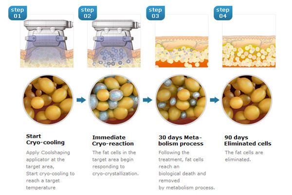 4 Griffe fettes einfrierendes Cryolipolysis, das Maschine mit großem Behälter des Wasser-8L abnimmt